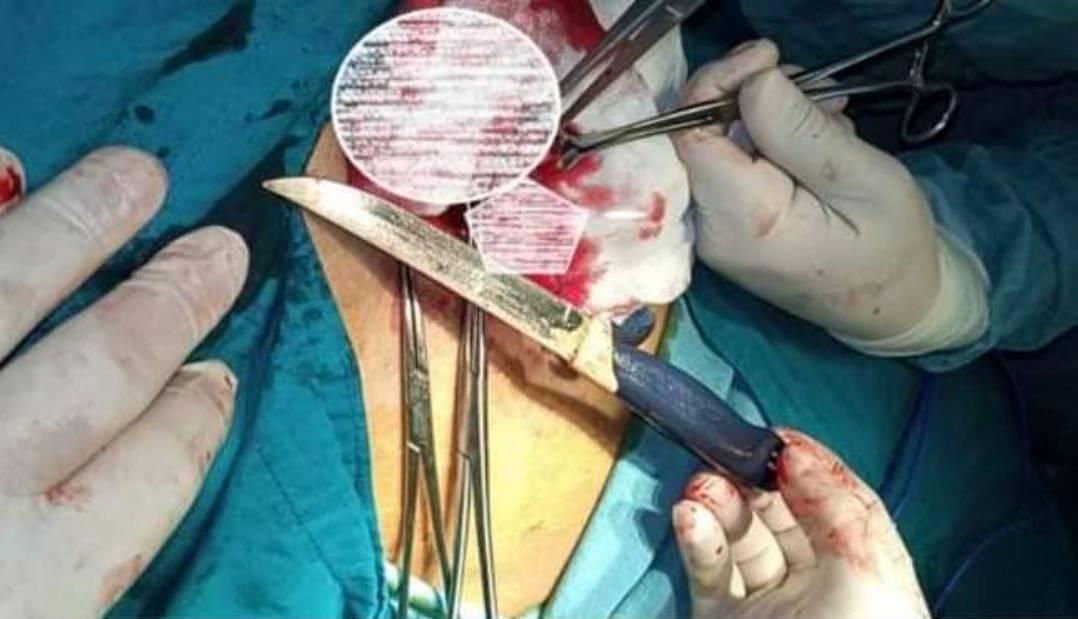 26 سال با یک چاقو در کمر