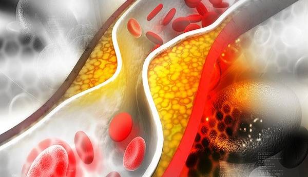 راهکارهای ساده برای کنترل کلسترول