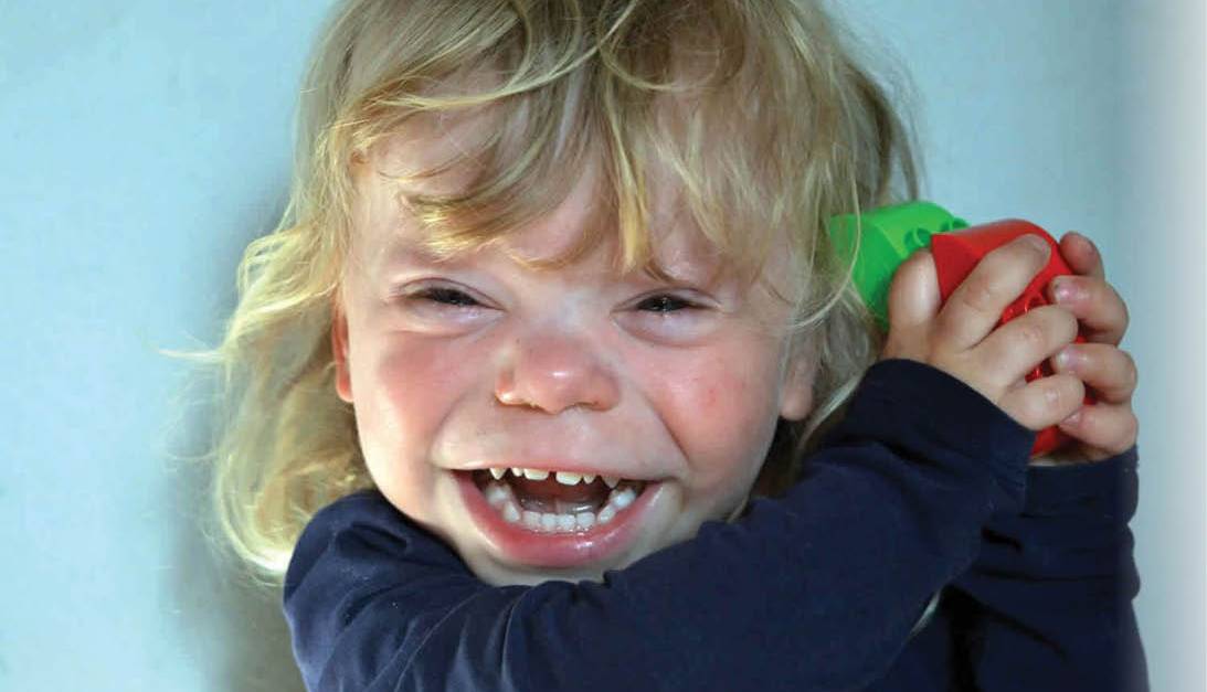 سندروم ویلیامز از چهره متفاوت تا استعداد در موسیقی