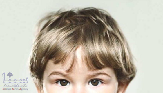 شناسایی اختلال اوتیسم با معاینه شبکیه چشم