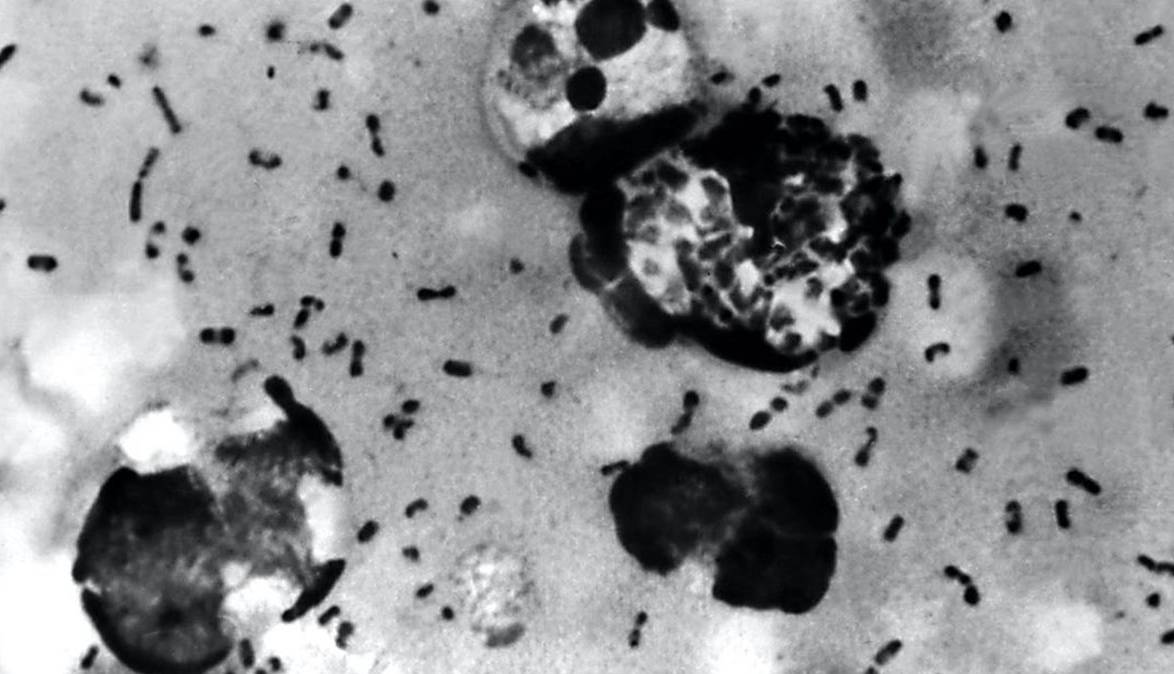 پاسخ یک معمای 700 ساله؛ محققان منشاء طاعون سیاه را پیدا کردند