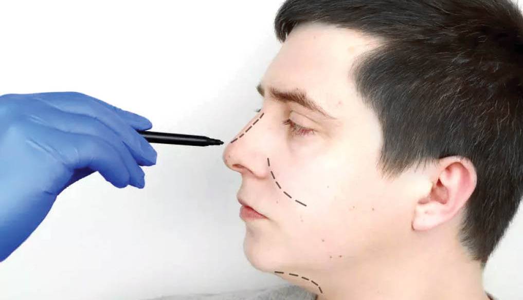 تیغ جراحی‌ زیبایی در کمین نوجوانان!