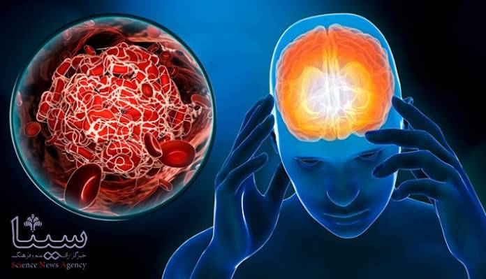 مغز با کمک این دارو خود را ترمیم می کند