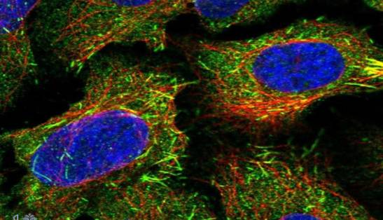 حتی سلول ها هم می خواهند تناسب اندام داشته باشند