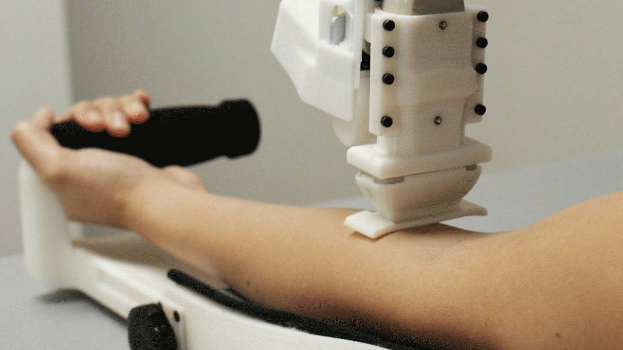 ربات خون گیری در چین!