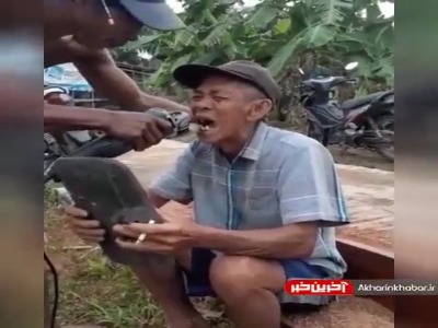 ایمپلنت دندون با ابزارآلات به روز دنیا