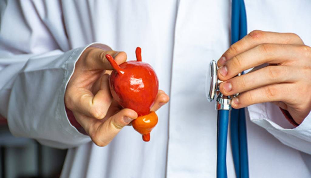 سرطان مثانه؛ چگونه علائم تومور در ادرار خود را شناسایی کنیم؟