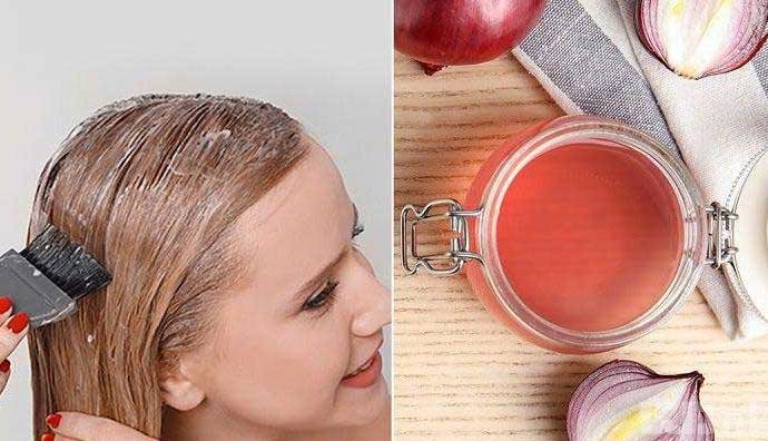 با یک پیاز رشد موهای خود را چند برابر کنید