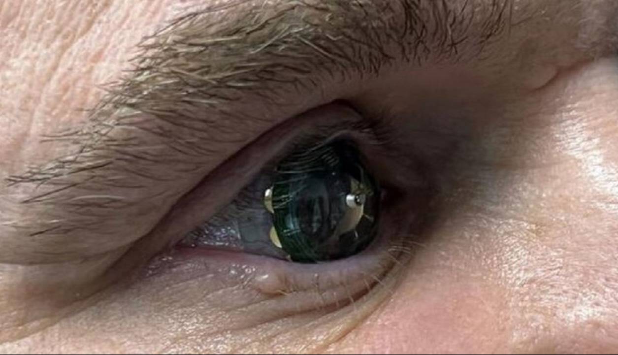 دیدی تازه به دنیا؛ لنز‌ هوشمند با قابلیت نمایش واقعیت افزوده روی چشم