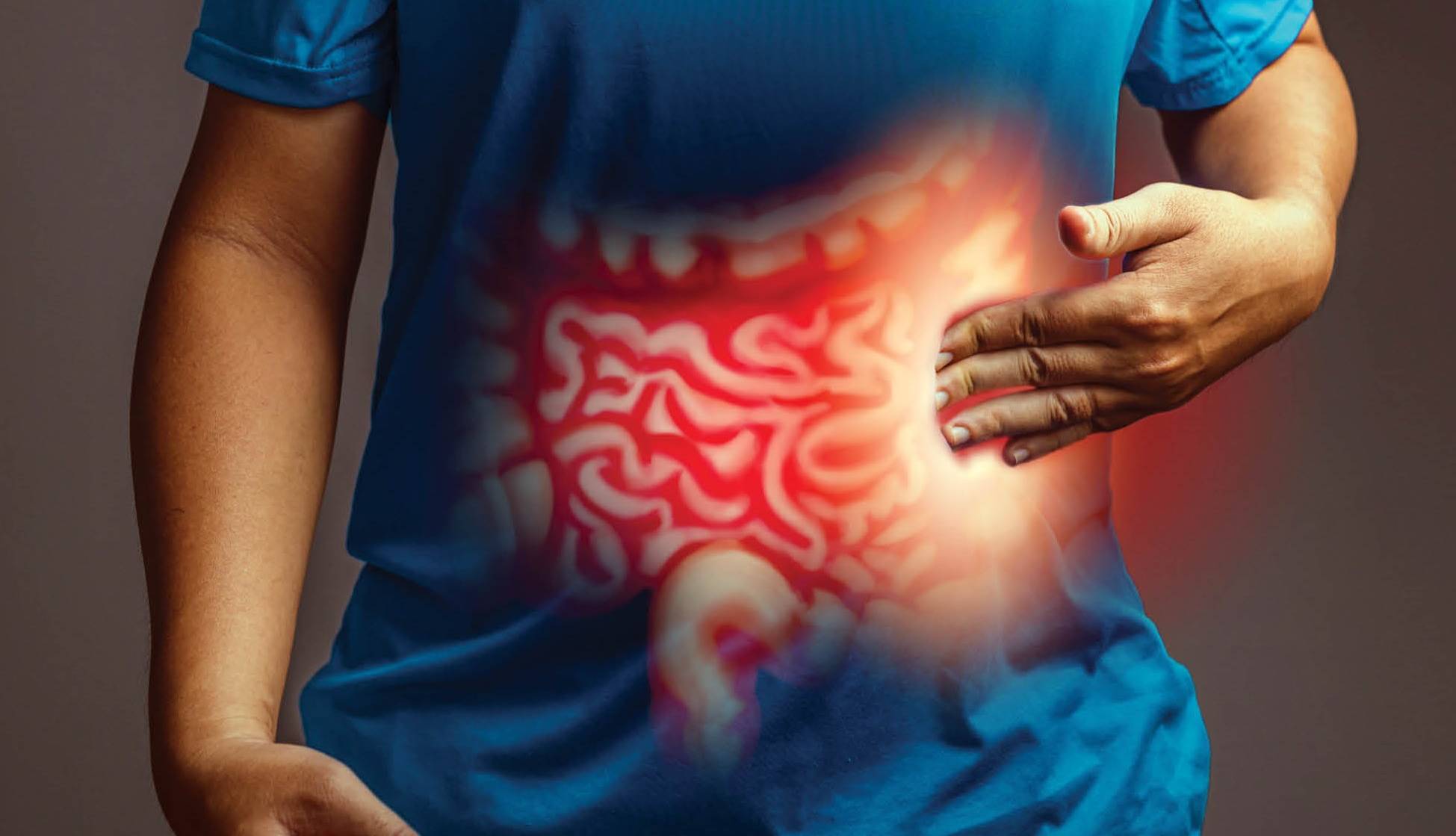 روده تحریکپذیر سندرومی ساکت ولی مزاحم روده تحریکپذیر سندرومی ساکت ولی مزاحم