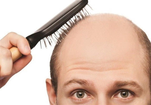 آیا طاسی با مصرف گیاهان دارویی برطرف می شود؟