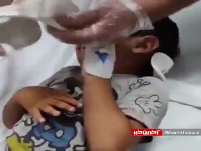 ماجرای بی‌پایان حمله ‎سگ‌های ولگرد این بار به یک خانواده