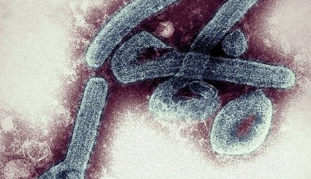 مرگ کودک مبتلا به ویروس “ماربورگ” در غنا