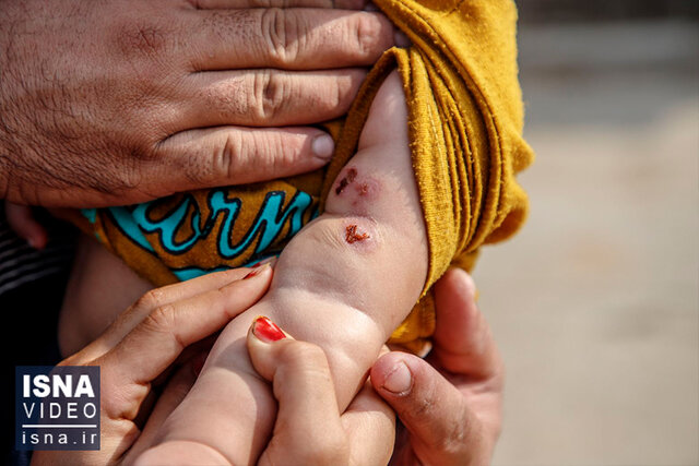 رابطه بیماری‌های واگیردار و سیل