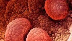 چطور از بروز سرطان جلوگیری کنیم؟