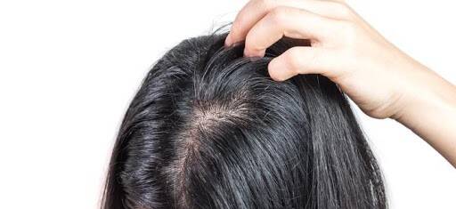 چه زمانی چربی پوست سر غیرطبیعی است؟