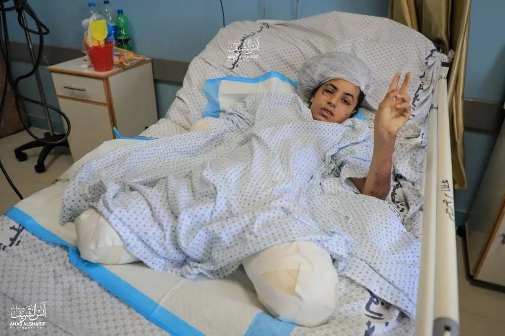 عکس/ علامت پیروزی یک دختر فسطینی با وجود از دست دادن اعضای بدنش
