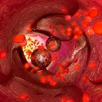 پروتئین خون احتمال ابتلا به دیابت و سرطان را پیش بینی می کند  