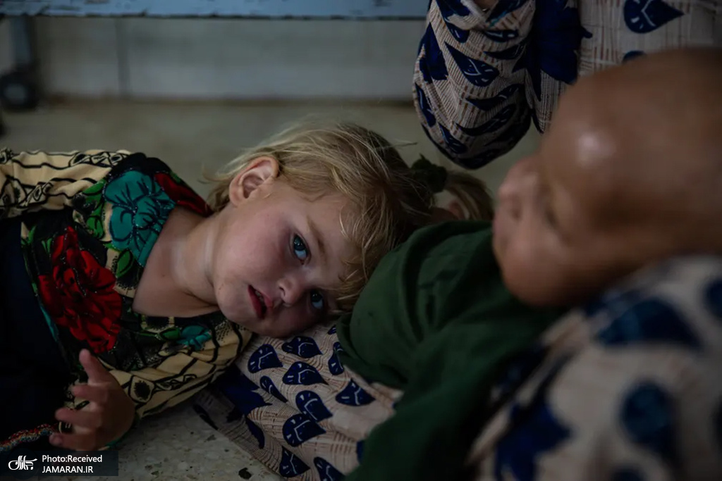 درمان کودکان دارای سوء تغذیه در افغانستان