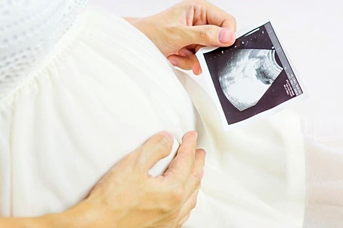 7 توصیه برای داشتن نوزاد باهوش و سالم در بارداری