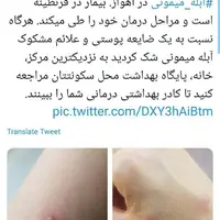 تصاویر ضایعه پوستی بیمار مبتلا آبله میمونی در ایران