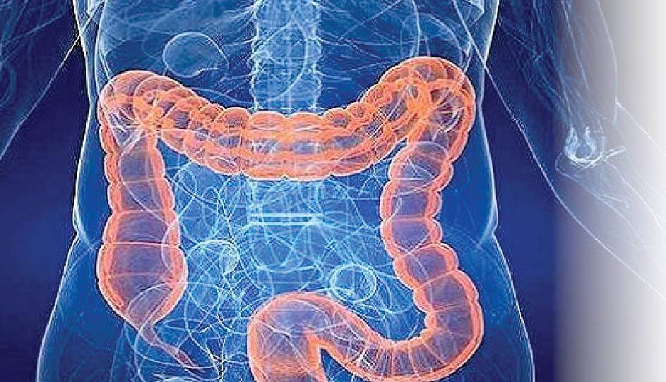 علایم و عوامل سرطان روده بزرگ