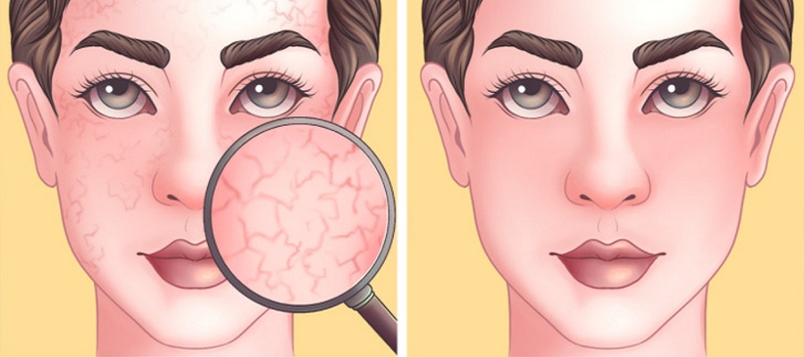 ۸ ترفند رایج در مراقبت از پوست که در واقع مضر هستند  