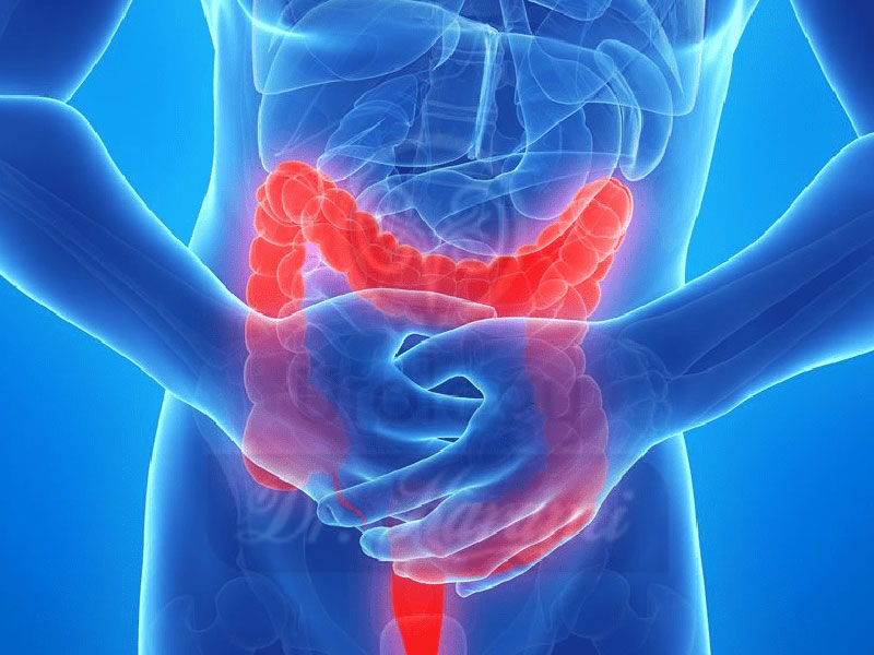 تاثیر غذای مانده بر سرطان روده و معده