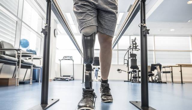 افزایش هزینه دست و پای مصنوعی، معلولان را خانه‌نشین کرد