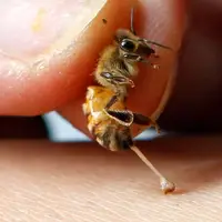 از بین بردن سلول‌های سرطانی با زهر زنبور عسل 