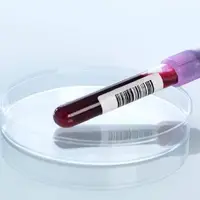 روش جدیدی برای تشخیص آلزایمر در خون