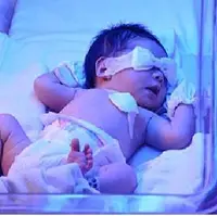 ناهنجاری‌های مادرزادی، مهم‌ترین عامل مرگ‌ومیر نوزادان در تیران‌وکرون