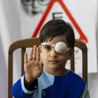 آغاز طرح پیشگیری از تنبلی چشم در مهریز