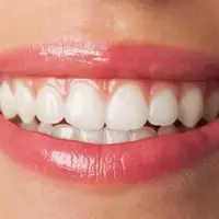 نکات مفید برای جلوگیری از پوسیدگی دندان