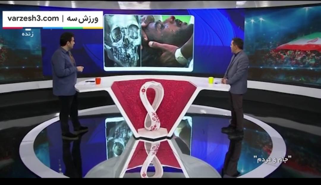 جامجهانی/ تصویری تکاندهنده از صورت یاسر الشهرانی