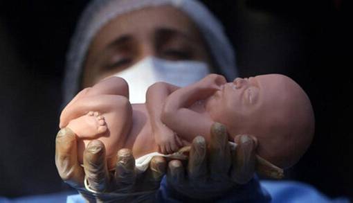 نتایج یک پژوهش درباره دلیل تولد یک میلیون جنین مُرده در سال