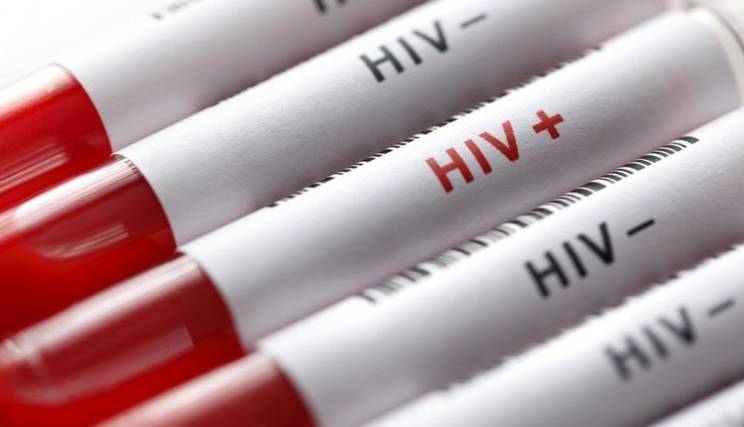 وجود 23هزار مبتلا به HIV در کشور