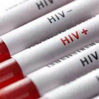 وجود 23هزار مبتلا به HIV در کشور