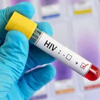 شناسایی ۱۶۸ بیمار مبتلا به ایدز در گلستان