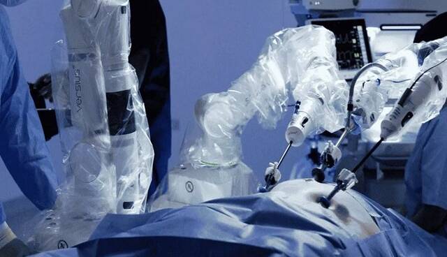 برداشتن تومور سرطانی توسط ربات جراح برای اولین بار