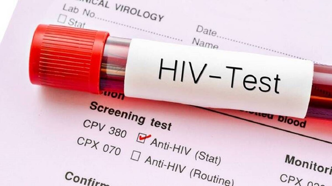 شناسایی ۲۳۳ بیمار مبتلا به ایدز در چهارمحال‌و‌بختیاری