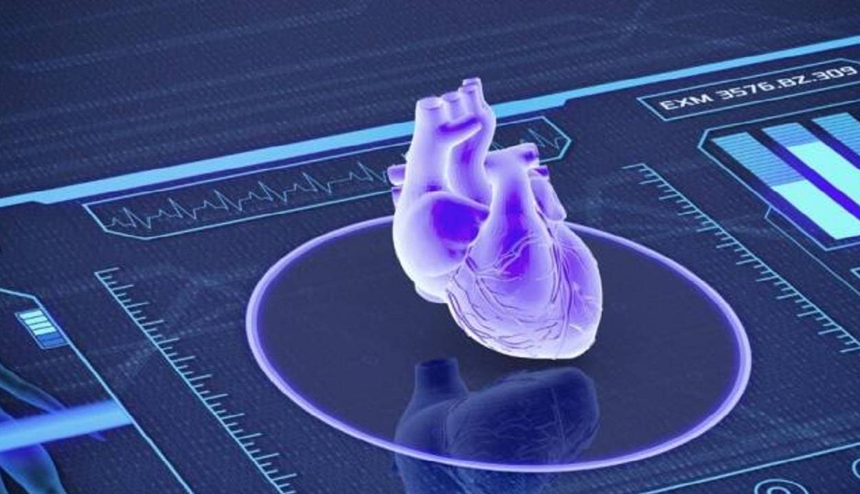 پیش‌بینی حمله قلبی با بررسی عکس رادیولوژی