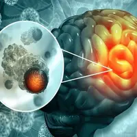 امید به درمان سرطان مغز و نخاع با یک روش جدید