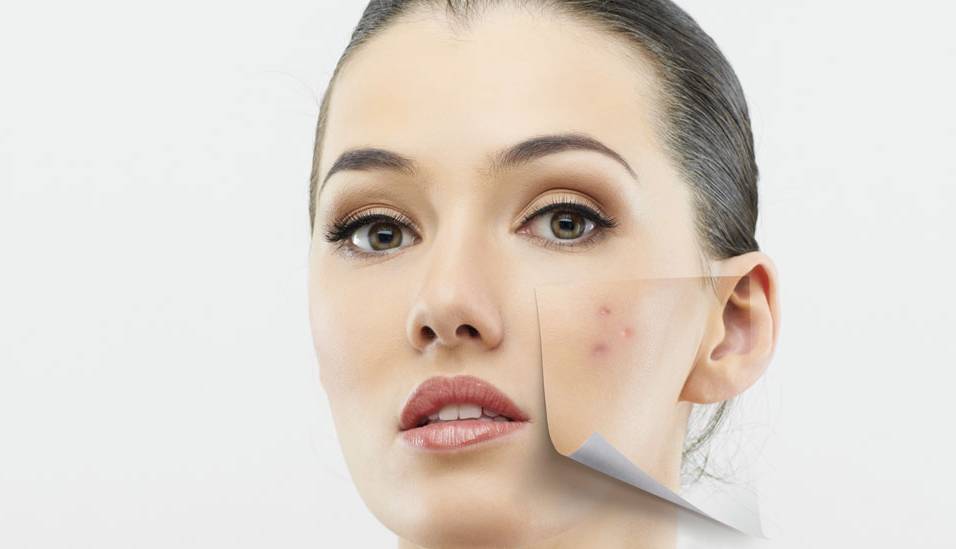 آخرین خبر چگونه در یک هفته پوست خود را صاف کنیم؟ آخرین خبر چگونه در یک هفته پوست خود را صاف کنیم؟