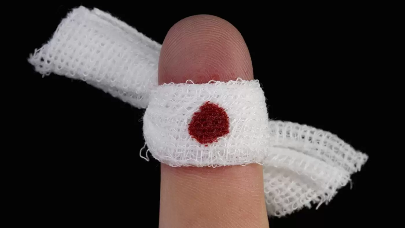 چند تکنیک مهم برای بند آوردن خون