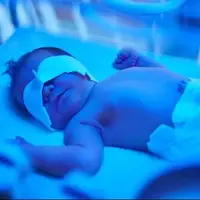 حجامت لاله گوش نوزاد برای درمان زردی هیچ مبنای علمی و مذهبی ندارد