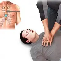آموزش اقدامات اولیه CPR
