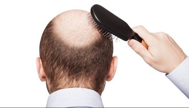 مکمل "بیوتین" در جلوگیری از ریزش مو موثر است؟