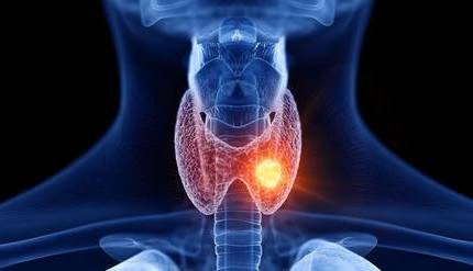 رژیم غذایی مناسب تیروئیدیت هاشیموتو