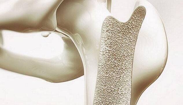 اینفوگرافی/ چند هشدار درباره پوکی استخوان در مردان